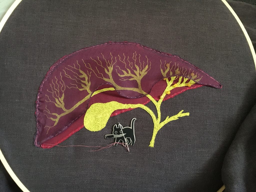 Liver embroidery in progress. 

A red organza liver is basted to grey linen. The main parts of the biliary system are outlined in 2-strand whipped backstitch and the smaller vesicles in 1-strand whipped backstitch in a very bilious green. Single strands of the same colour floss fill the biliary system in long and short stitch. There are about 6 small yellow agate beads on the part of the biliary system inside the smaller lobe. A slightly smaller purple organza liver is basted over the biliary system. The bottom edge of the red liver is being covered with purpleish satin stitch. A knifecat needle minder holds the very tiny needle. 