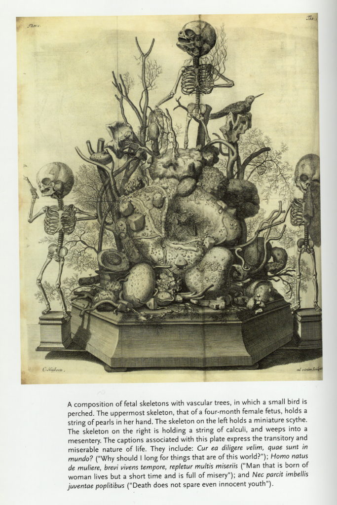 Ruysch Diorama: 
A scan from a book with an engraving of a Frederick Ruysch diorama and descriptive text beneath. The text reads: A composition of fetal skeletons with vascular trees, in which a small bird is perched. The uppermost skeleton, that of a four-month female fetus, holds a string of pearls on her hand. The skeleton on the left holds a miniature scythe. The skeleton on the right is holding a string of calculi, and weeps into a mesentery. The captions associated with this plate express the transitory and miserable nature of life. They include: Cur ea diligere velim, quae sunt in mundo? ("Why should I long for things that are of this world?"); Homo natus de muliere, brevi vivens tempore, repletur multis miseriis ("Man that is born of woman lives but a short time and is full of misery"); and Nec parcit imbellis juventae poplitibus ("Death does not spare even innocent youth"). 