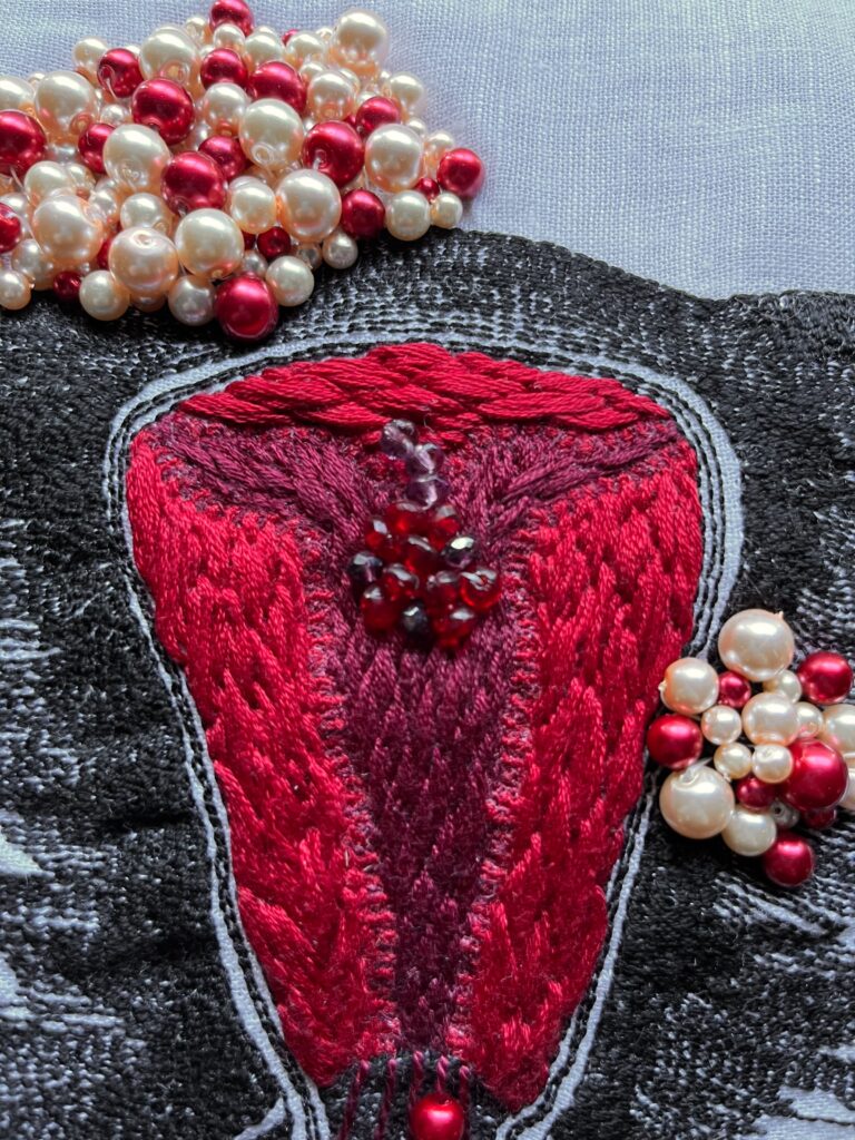 An embroidery of a uterus stitched in black thread on white linen with texture like a woodcut. Inside the uterus, the edges of the endometrium are stitched in bright red thread with long and short stitch in a textured leaf pattern. The centre endometrium is filled with the same texture but in burgundy with thinner thread. The edges between the burgundy and the bright red are filled with single strand satin stitch with curlicue edges. There is an apple-sized half circle fibroid on the left upper area of the uterus and a strawberry sized one on the middle right side. In the centre of the endometrium are some dark burgundy and red beads representing a cancerous polyp.
